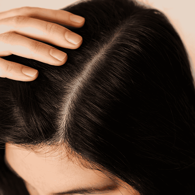 Close-up of healthy scalp and thick hair showing visible improvement after Calistara™ red light therapy treatment