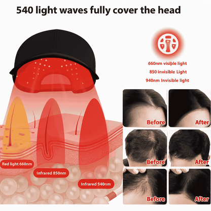 Calistara™ Red Light Therapy Cap using 540 light waves with visible and infrared LEDs for full scalp hair regrowth treatment, showing before and after results
